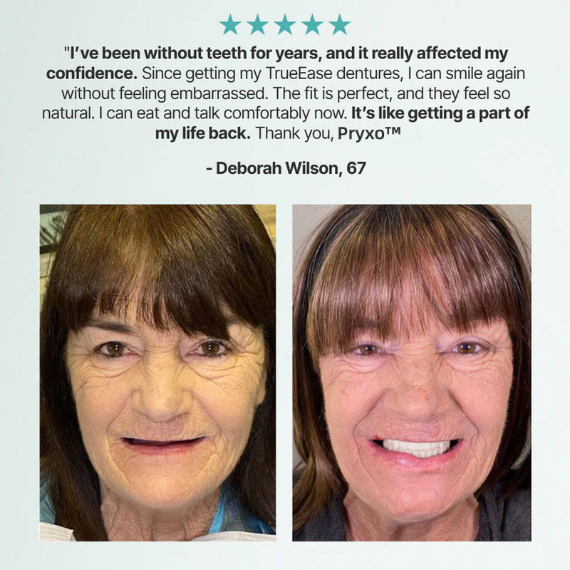 Ends Today: 70% OFF! Pryxo™? Custom-Fit Full Functional DenturesMake you more confident